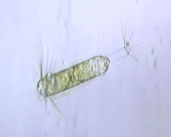 Marine diatom Corethron sp. Marine diatom Corethron sp.