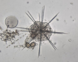 Acantharean The skeleton is composed of Strontium sulphate.