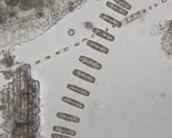 Unidentified sp. An unidentified marine diatom.