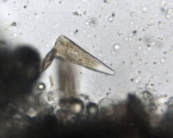 Licomorpha sp. A common north-east Pacific marine diatom.