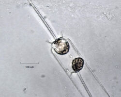 Ditylum sp. Diatom Ditylum sp.