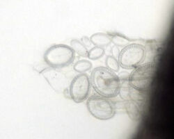 Cocconeis sp. A common north-east Pacific marine diatom.