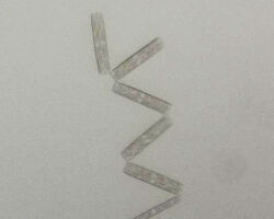 Thalassionema sp. A common north-east Pacific marine diatom.