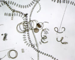 Phytoplankton Phytoplankton