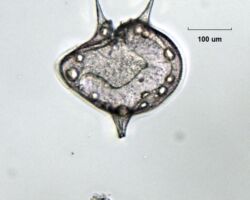 Dinoflagellate Protoperidinium sp. Dinoflagellate Protoperidinium sp.