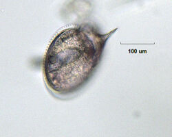 Dinoflagellate Protoperidinium sp. Dinoflagellate Protoperidinium sp.