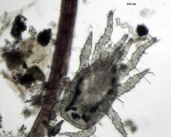 Water Mite Hydracarina